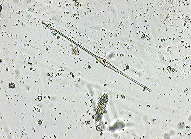 Dictyocha speculum